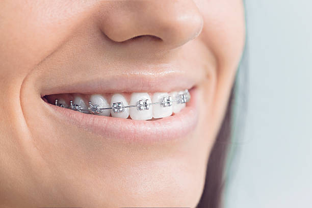 Best Veneers and Lumineers  in Centerville, OH